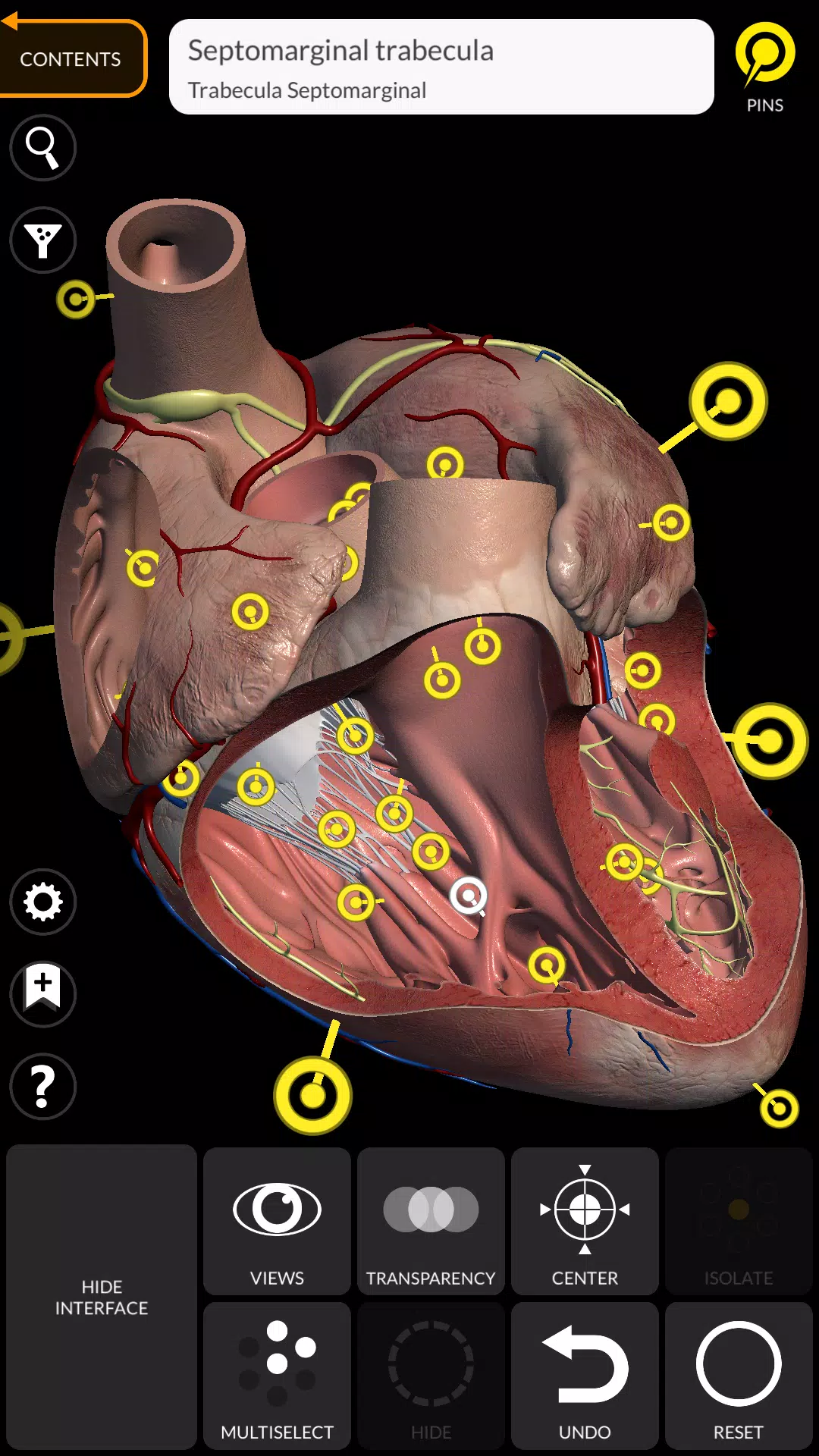 Anatomy 3D Atlas 스크린샷 2