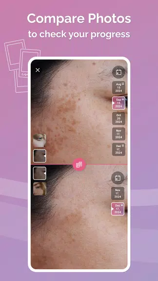 FeelinMySkin: Skincare Routine应用截图第2张