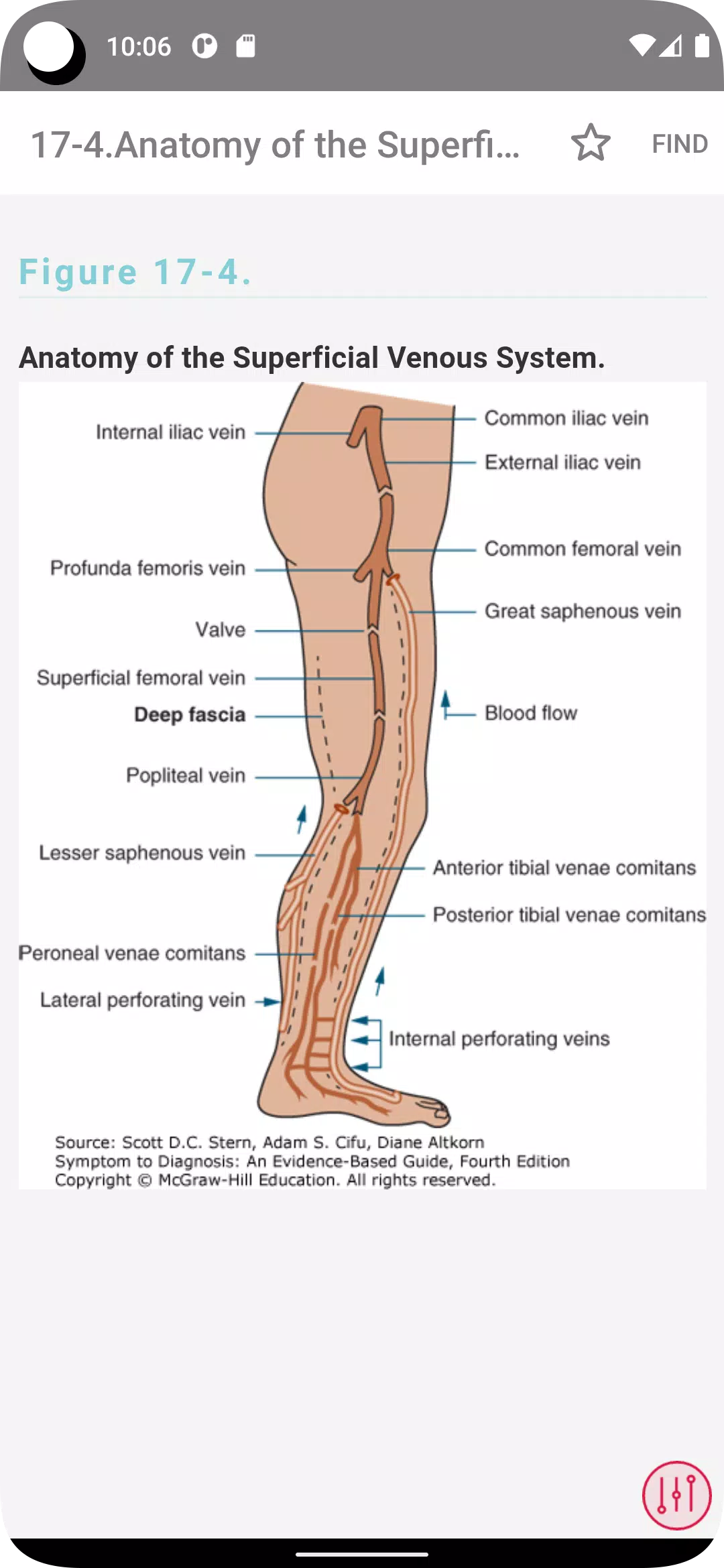 Symptom to Diagnosis应用截图第1张