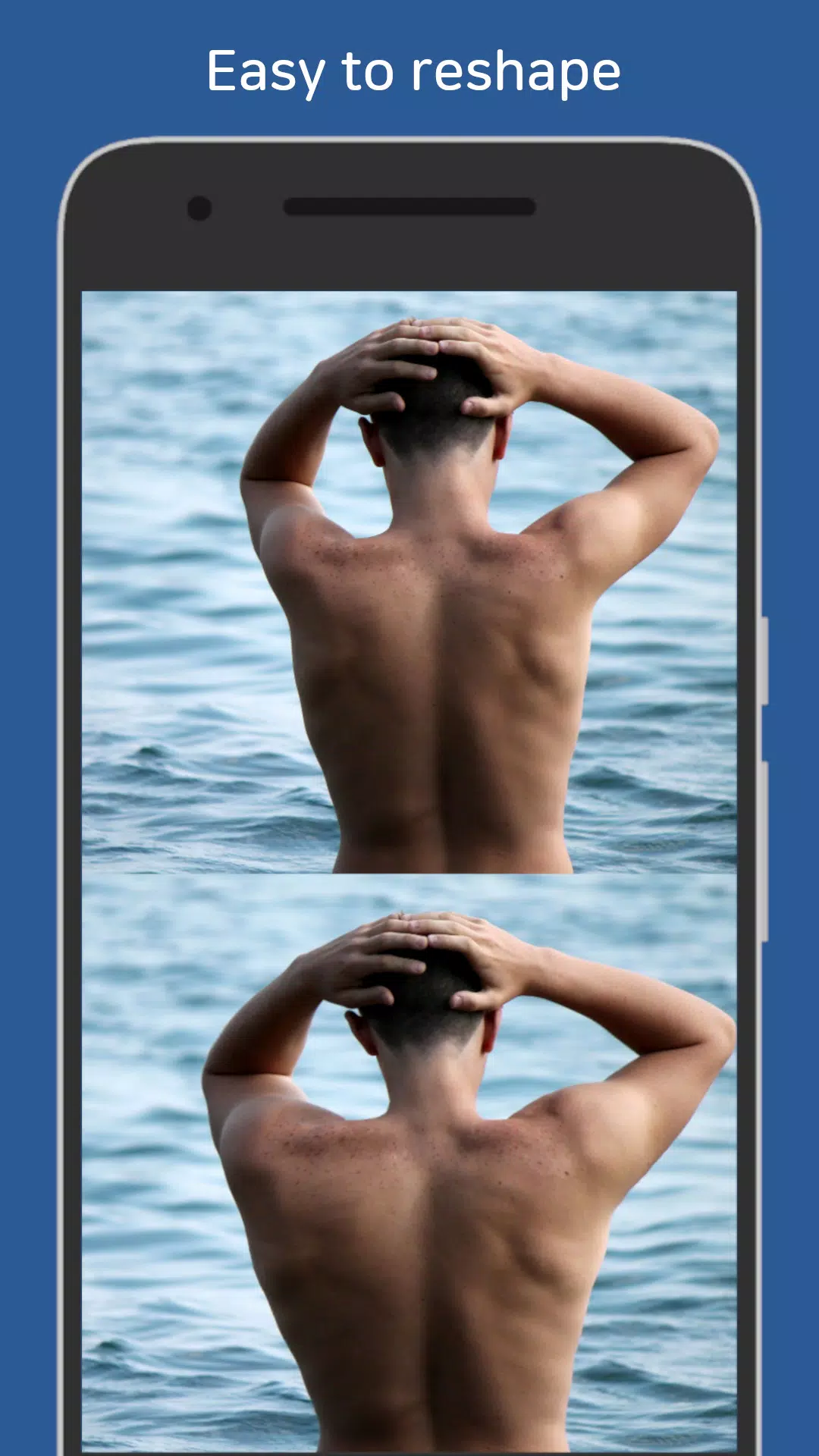 Body Plastic Surgery應用截圖第1張